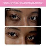 Iris 2 Eye Massager