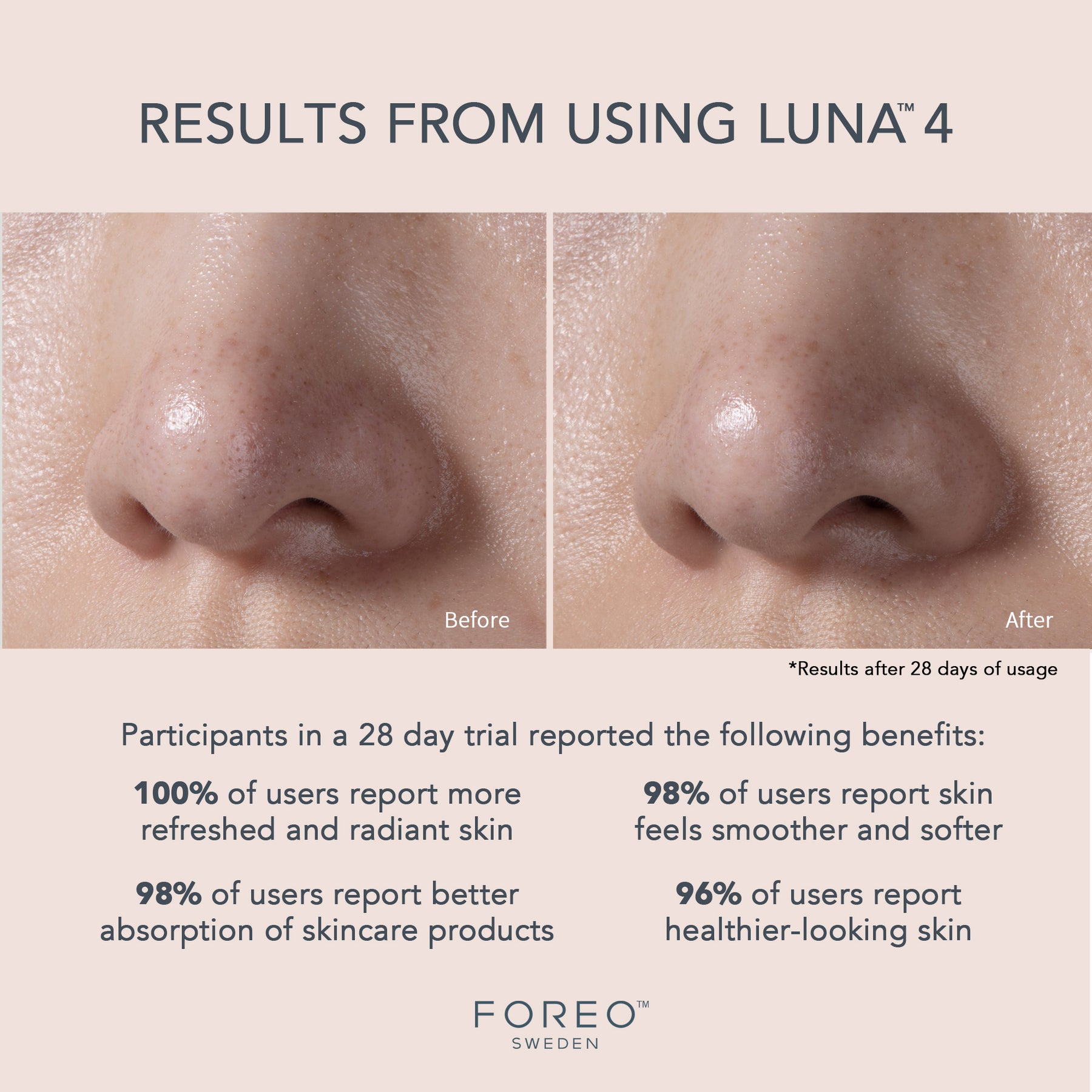 Luna 4 Balanced Skin